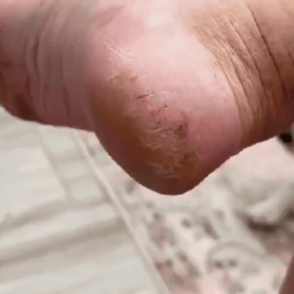 Râpe Électrique pour Pieds